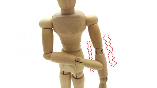 腕のしびれを表したデッサン人形