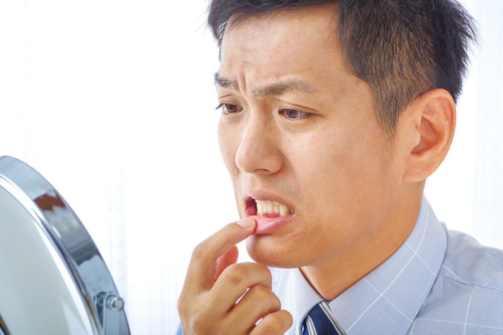 抗癌剤の副作用、口内炎の予防と痛み別対処法