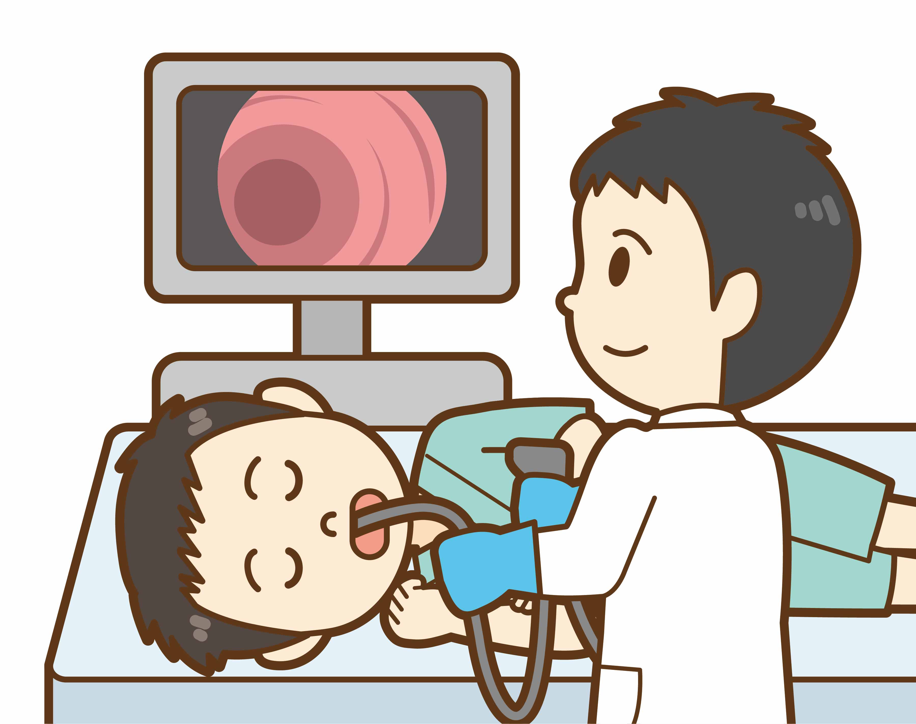 胃カメラを実施しているイラスト