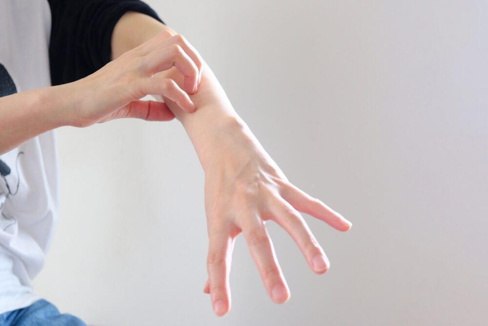 悪性リンパ腫で現れる発疹の種類と症状を詳しく解説