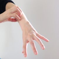 悪性リンパ腫で現れる発疹の種類と症状を詳しく解説